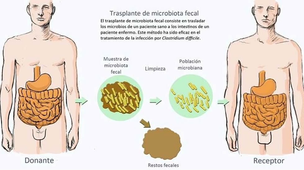 infección fecal