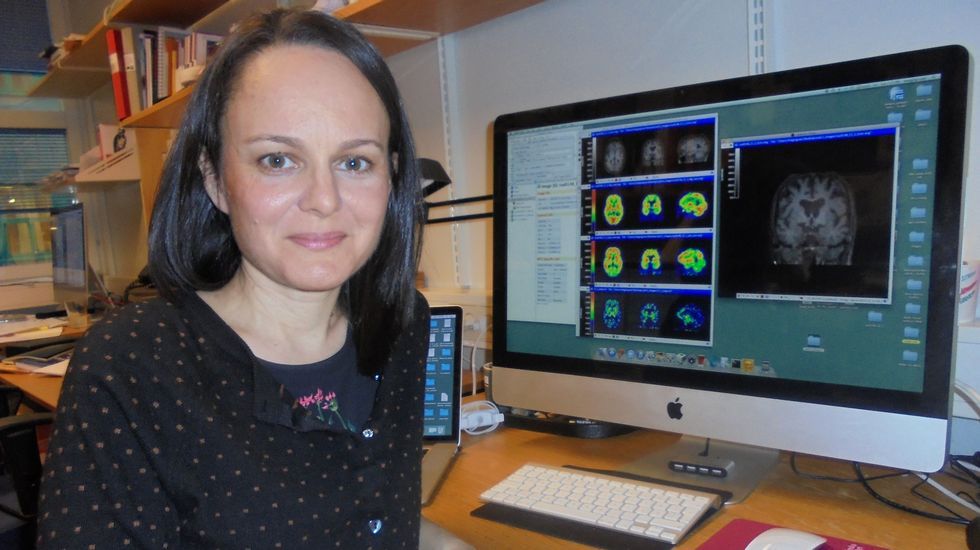 que es el cerebro inflamado
