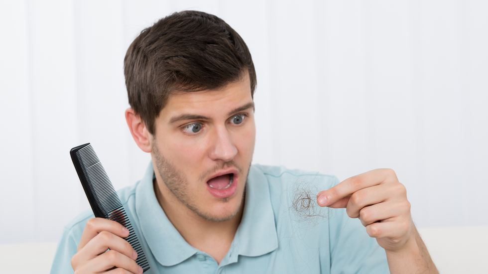 A que se debe la caida constante de cabello A que se debe la caida constante de cabello