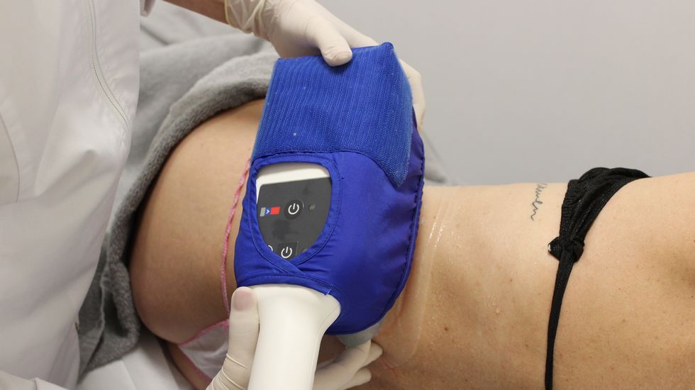 Tratamientos para adelgazar sin cirugia