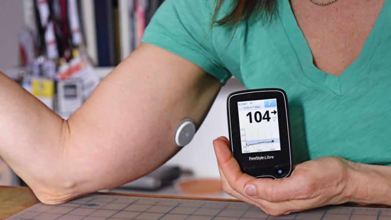 sensores de glucosa implantables registro de monitoreo de diabetes