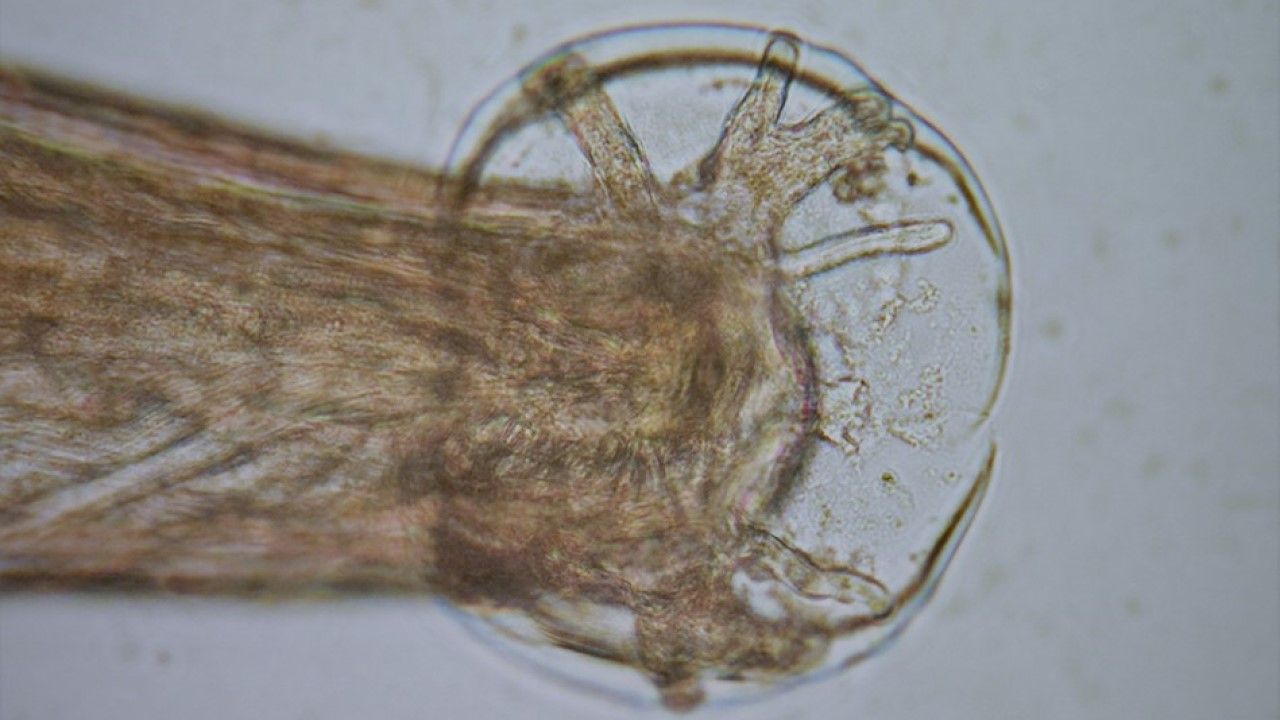 Detectan Por Primera Vez En Espana Un Tipo De Gusano Parasitario Que Causa Meningitis