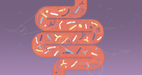El trasplante de materia fecal ya es un tratamiento contra la infeccin por clostridium difficile recurrente y refractaria.