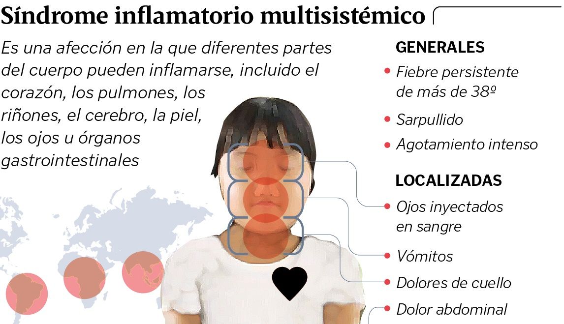 El síndrome inflamatorio multisistémico