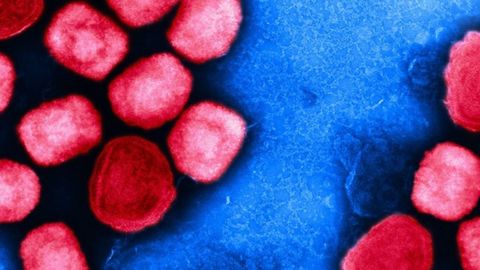Micrografa electrnica de transmisin coloreada de partculas del virus de la viruela del mono (rojo) cultivadas y purificadas a partir de un cultivo celular