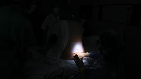 Una mujer reciba la epidural hace apenas unos das en el hospital de Lugo
