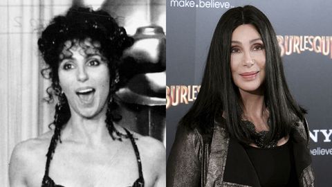 Cher.Cher, una de las primeras famosas adictas al bistur