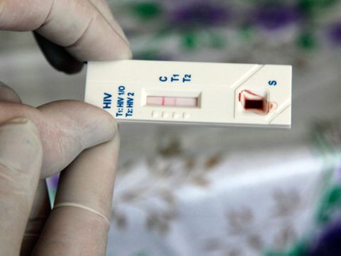 Un test rpido del VIH-SIDA