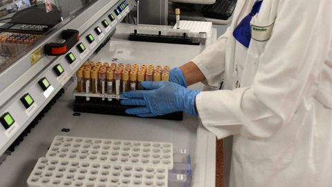 Pruebas de sangre analizadas en un laboratorio de Vigo
