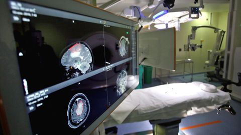 Imagen del quirófano más moderno del Cunqueiro, el de neurocirugía que dispone de tac intraoperatorio y neuronavegador.