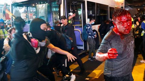 Un manifestante es atacando con un martillo por grupos prochinos