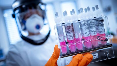 En todo el mundo se están desarrollando decenas de investigaciones para encontrar una vacuna para el covid-19