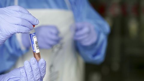 Un sanitario protegido con guantes sostiene un muestra para realizar un Análisis PCR.