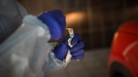 Pruebas de coronavirus en el CHUO