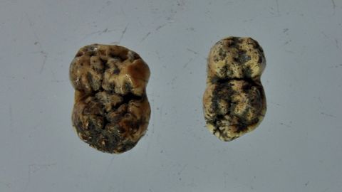 Dientes de cerdo extraídos de una tumba del cementerio medieval de Cereixa, que ahora se está intentando datar mediante un análisis de carbono 14