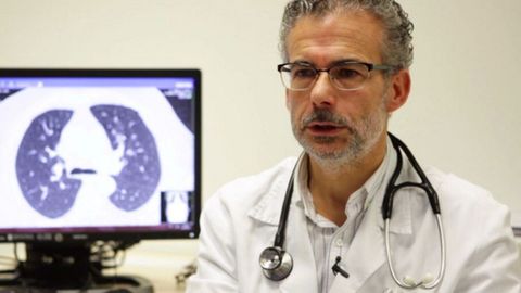 Dr. José Alberto Fernández Villar, jefe de Neumología y responsable de la Unidad Post-COVID del Complejo Hospitalario Universitario de Vigo