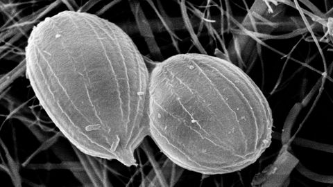 Imagen de la microalga