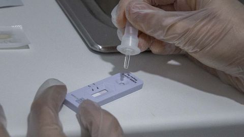 Un test de antígenos
