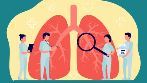 La EPOC se caracteriza por la obstrucción del aire que entra y sale de los pulmones, lo que causa dificultad para respirar.