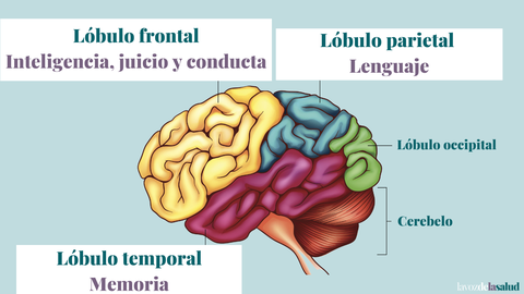 Las zonas marcadas con un recuadro blanco son las más afectadas desde el inicio de la enfermedad de alzhéimer. Fuente: Dr. Pedro Montejo. Gráfico: La Voz de la Salud