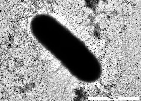 E. coli aislada de alimentos frescos (leche). Está fotografiada a 30.000 aumentos con un microscopio electrónico. Por esos pelos es por donde se agarra a las células.