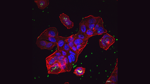 En la fotografía de microscopía confocal, vemos unas células de intestino humanas cultivadas en el laboratorio (rojas con el núcleo azul) que están siendo atacadas por las E. coli, que son los puntos verdes. Estas E. coli tienen un mecanismo especial de adherencia a las células humanas, con lo que terminan desencadenando una infección intestinal.