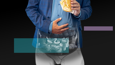 El síndrome de intestino irritable es un trastorno funcional crónico que afecta a entre un 10 y un 15 % de la población.
