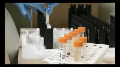 Pruebas para la detección de la viruela del mono