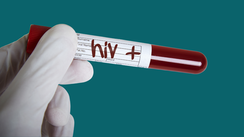 Hay más de 38 millones de personas con VIH en el mundo.