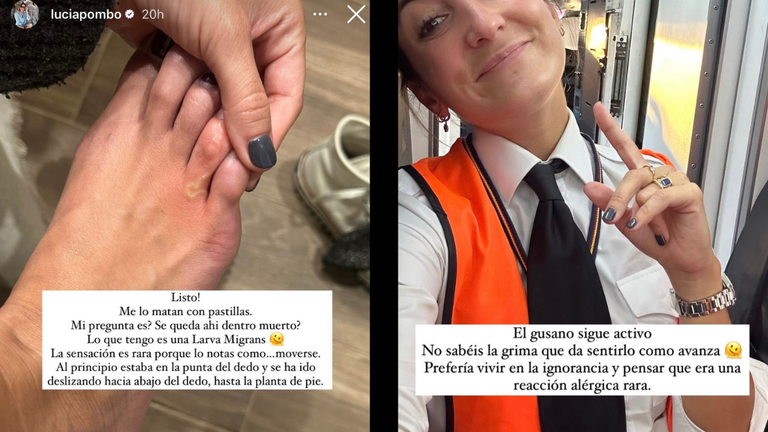 Dos capturas de los stories de Lucía Pombo en los que relataba el estado de la Larva Migrans.