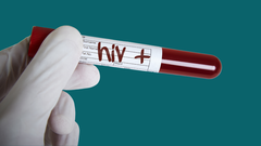 Hay m�s de 38 millones de personas con VIH en el mundo.