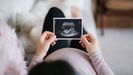 Una mujer embarazada mira una ecografía en una imagen de archivo