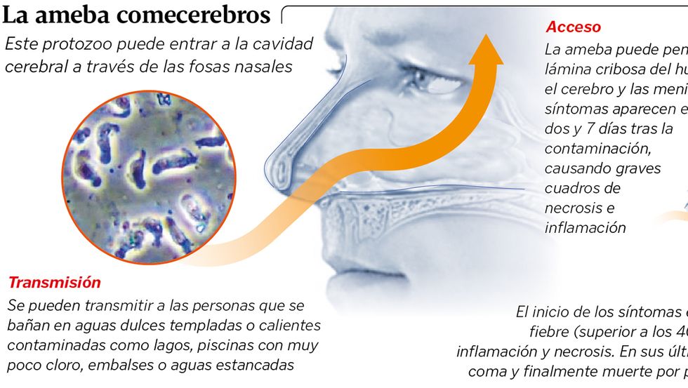 parásito del cerebro del agua del lago parásito del cerebro del agua del lago