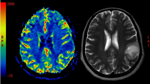 Imagen de archivo de una resonancia magn�tica.