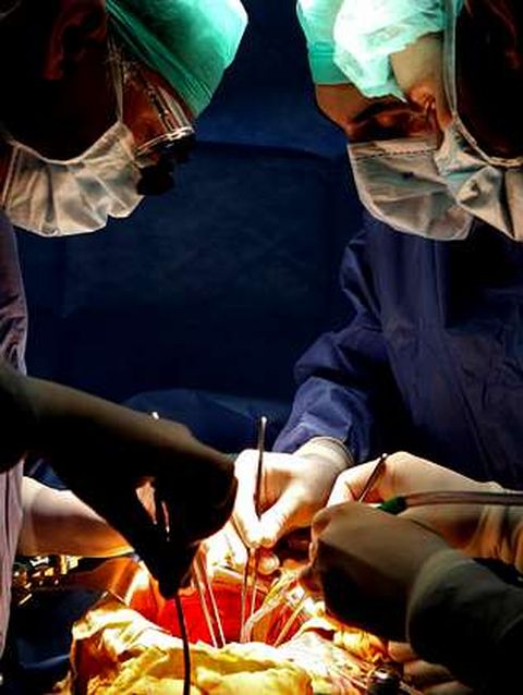 Cirujanos del Chuac realizando un trasplante de rin.