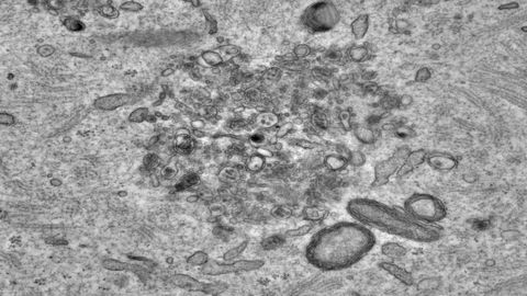 Imagen microscópica de los superorgánulos que deambulan por el citoplasma para eliminar los agregados de proteínas que dañan a los ovocitos. Actúan como un mecanismo de limpieza