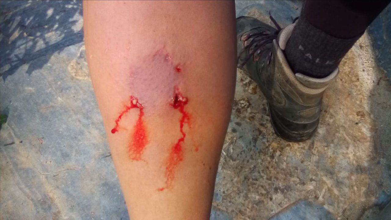 Leve el conductor de una hormigonera tras volcar en Samos.Sugar Drops act�a en el Clavic�mbalo