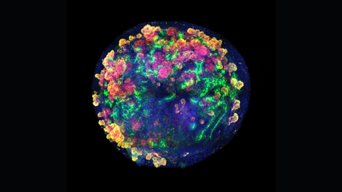 Imagen de un organoide de ri��n en el d�a 16 de diferenciaci�n obtenida por microscop�a confocal. Esta imagen permite observar c�mo se organizan los diferentes tipos de c�lulas dentro del organoide renal.