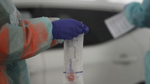 Primer plano de un test de coronavirus antes de ser realizada una prueba rpida en Santiago
