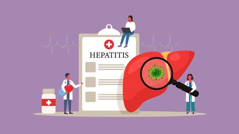 La hepatitis C es una inflamación del hígado provocada por un virus.