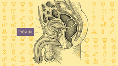 El cncer de prstata es el tipo de cncer ms comn entre los varones. 