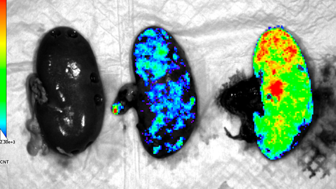Monitorizaci�n de ri�ones porcinos despu�s de la perfusi�n de organoides renales humanos mediante m�quinas de perfusi�n normot�rmica ex vivo. A la izquierda, un ri��n porcino sin organoides. En el centro y a la derecha, ri�ones porcinos perfusionados con organoides renales humanos, administrados a diferentes dosis.