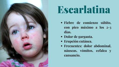La escarlatina es una faringoamigdalitis aguda (anginas) asociada a un exantema (erupción en la piel)