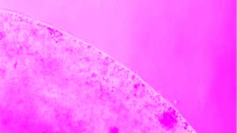 Imagen microscopio óptico, vistas parciales de dispositivo flexible desarrollado con biopolímeros cargado con linfocitos. Se aprecia el borde externo del dispositivo, con las  que van migrando hacia afuera.