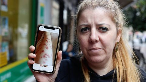 María Rey muestra en su teléfono las fotografías de cómo le quedaron las piernas tras la depilación láser