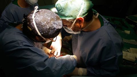 Cirujanos cardacos operando en el Chuac