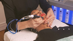 El tratamiento revitaliza el aspecto de la piel.