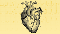 M�s de 700.000 personas en Espa�a padecen insuficiencia card�aca.