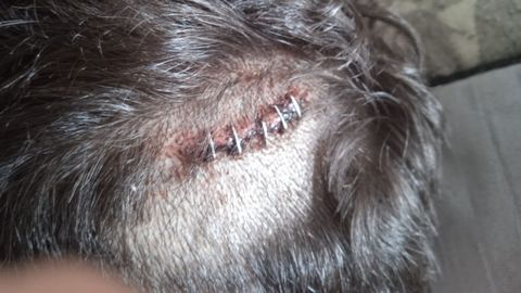 Imagen de una de las heridas producidas por un puño americano en una agresión a un menor