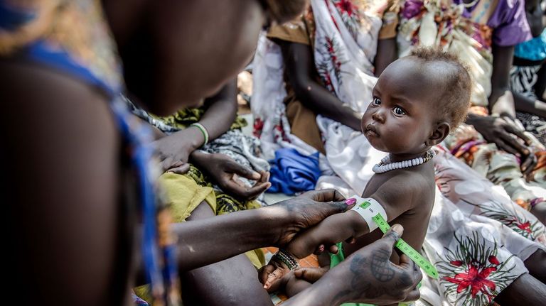 Medición del nivel de malnutrición de un niño en un campo de refugiados de Etiopía.